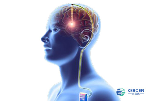 大脑起搏器